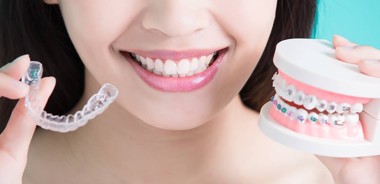woman holding invisalign and braces