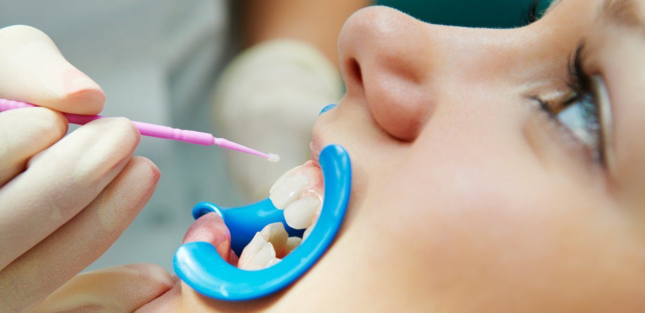 child getting fluoride treatment