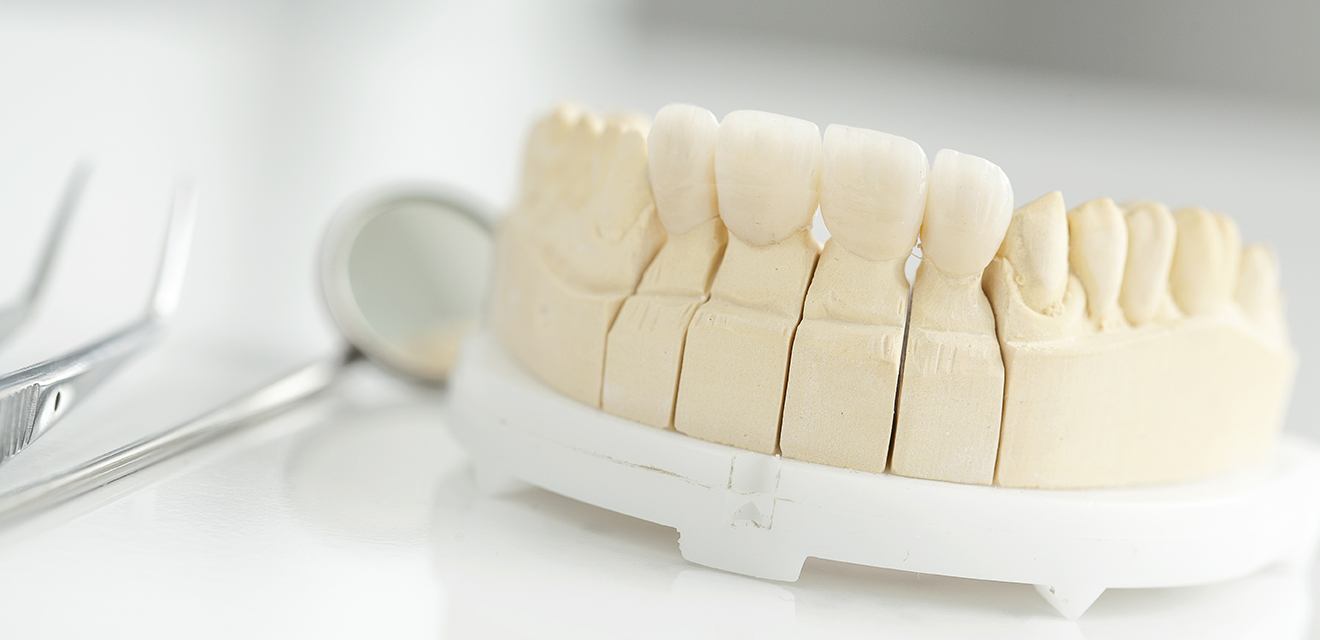 ceramic crowns