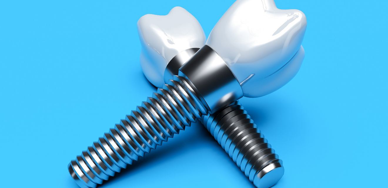 Closeup of dental implants in Denver on blue background 