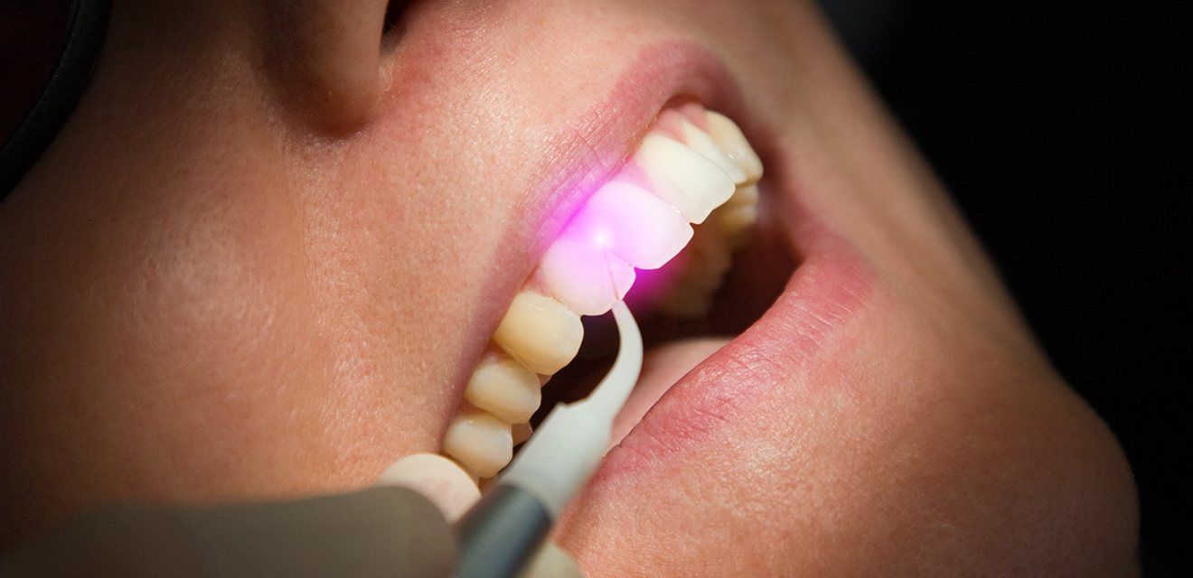 laser behind tooth