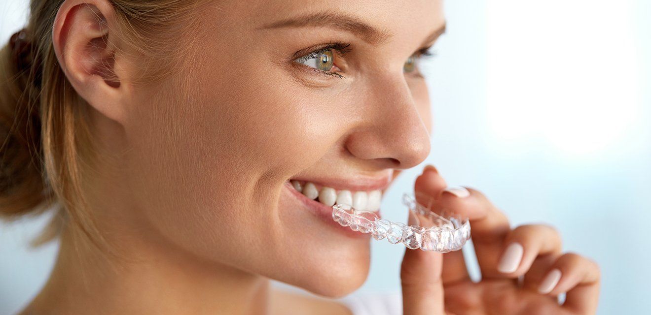 woman putting in invisalign