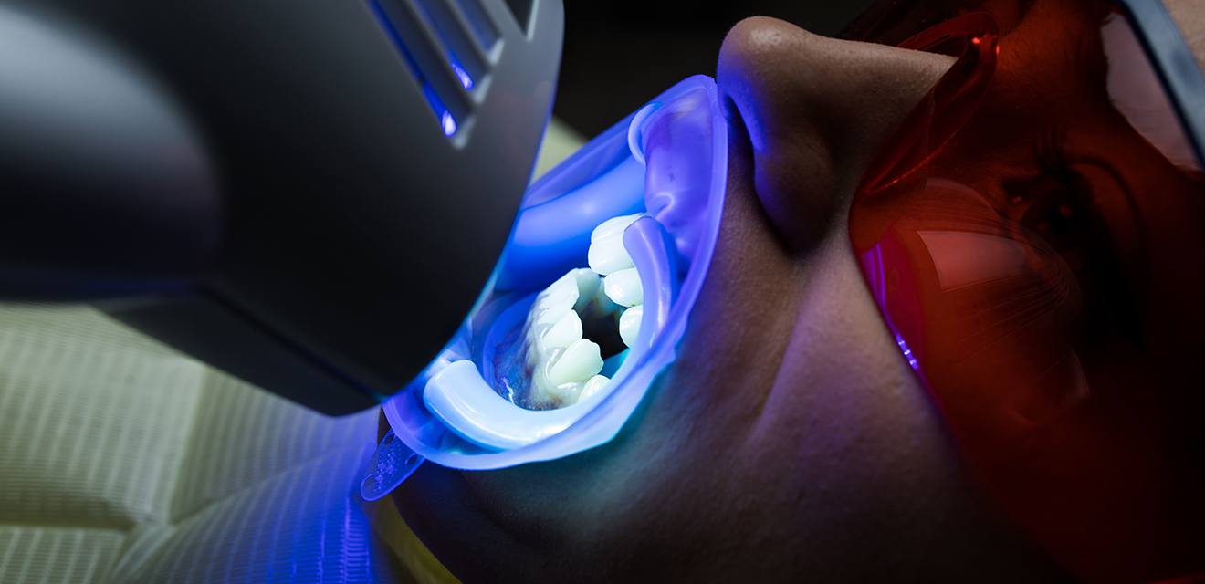 woman getting zoom whitening