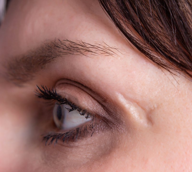 person with a facial scar near their eye.