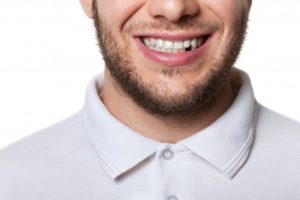 a man showing his tooth loss